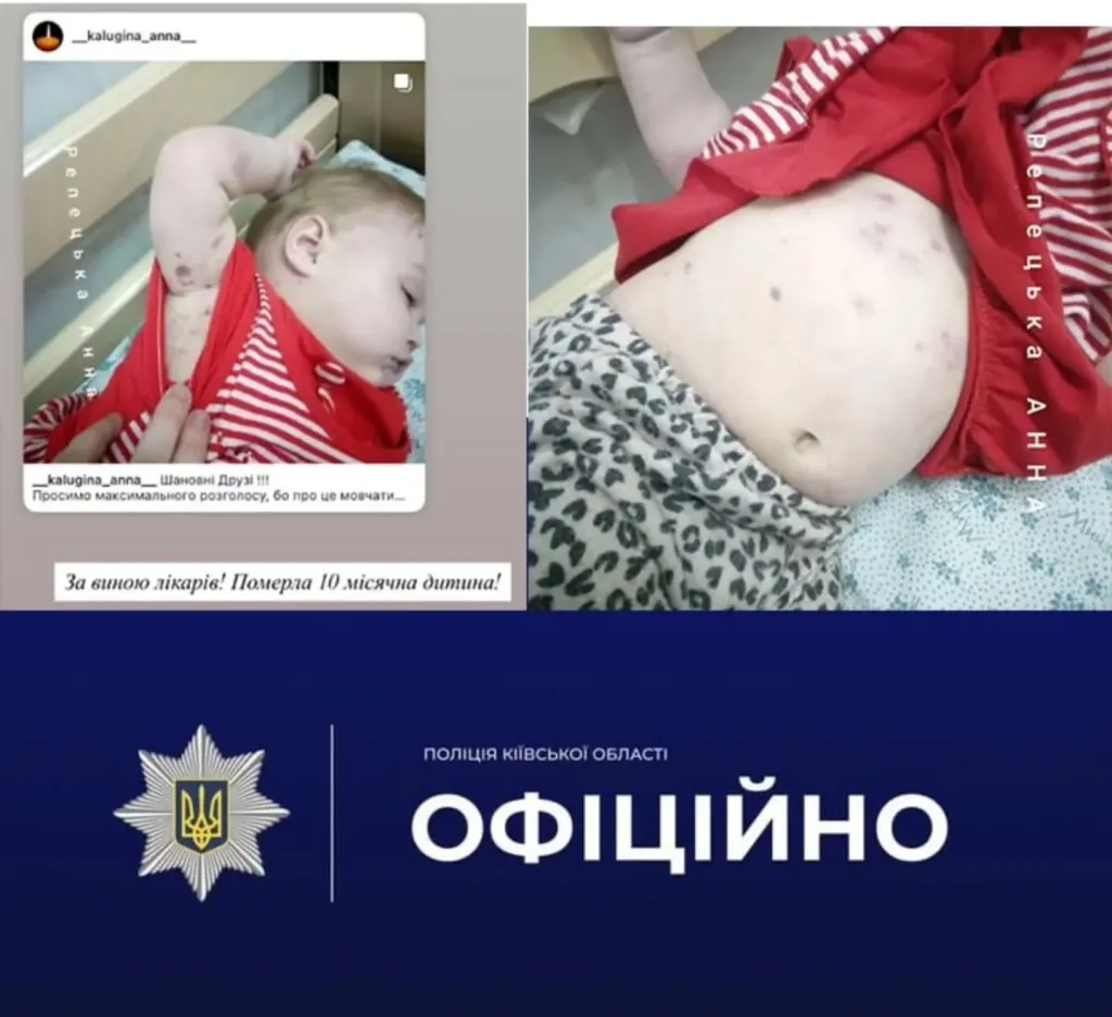 У Білій Церкві поліція розслідує смерть немовляти в лікарні